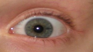 eyeball